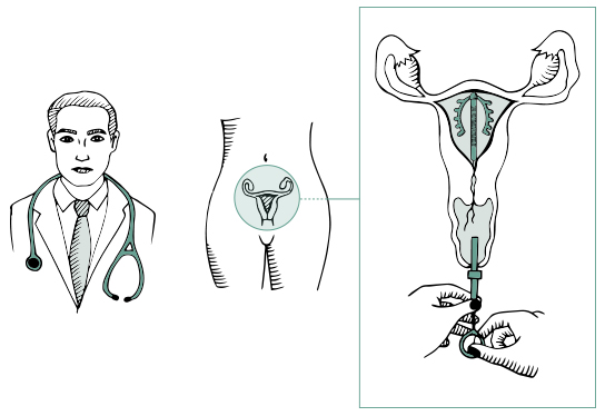 koperspiraal_howto