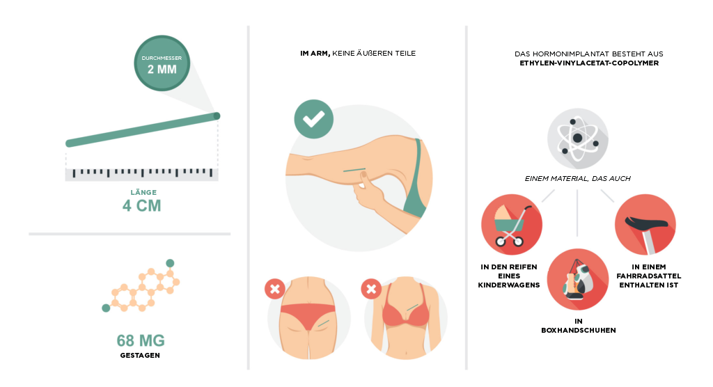 L’IMPLANT HORMONAL